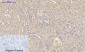Integrin β3 Polyclonal Antibody